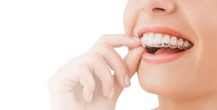 Invisalign Dentists Treatment