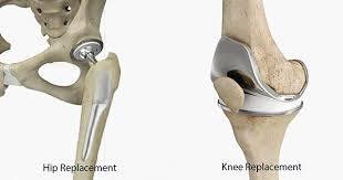 Why Dr. Shohab Hyder Shaikh is the Best for Sports Injury Surgery in Karachi