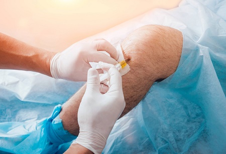 Knee Pain doctor financial district